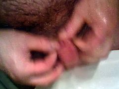 RASAGE DE BITE