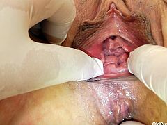 Old slut Slavomira lays naked on the doc's table to be examined. The doc looks at her ass and vagina and then asks her to take a sit on the gynecology chair. She does that and then he inserts a plastic speculum in her vagina. Yeah, look at the insides of her pussy, so juicy and hot!