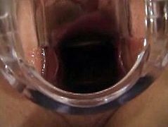 Speculum