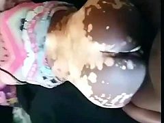 Fucking Ebony Wet Vitiligo Pussy.