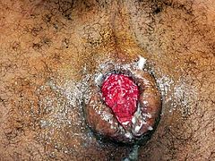 ROSEBUTTDARK HOLE GAPE