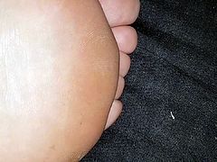 Wrinkled foot soles arches